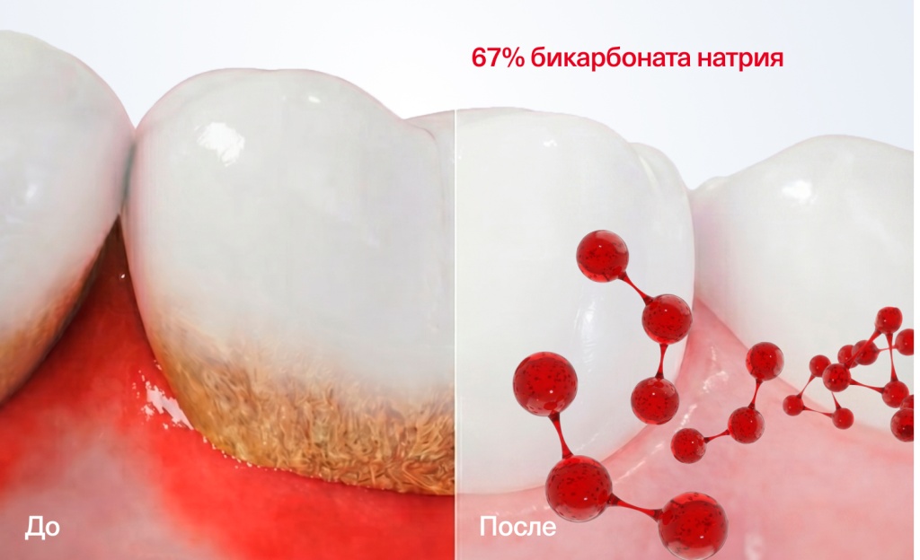 Эффективный ингредиент:
БИКАРБОНАТ НАТРИЯ 